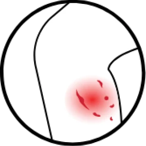 icon-Mordeduras de animales